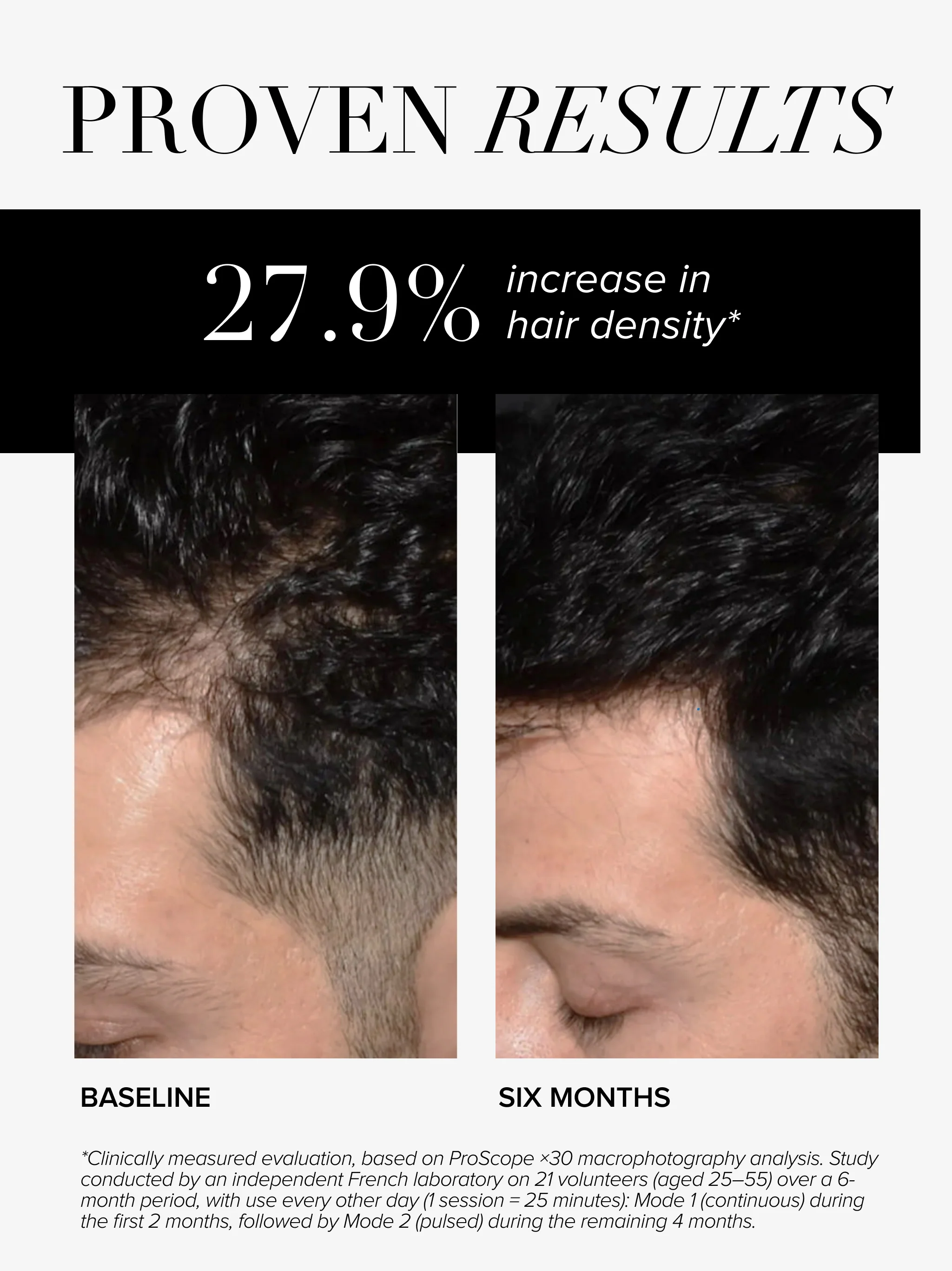 Anti-hair Loss and Regrowth Hair Helmet - Image 4
