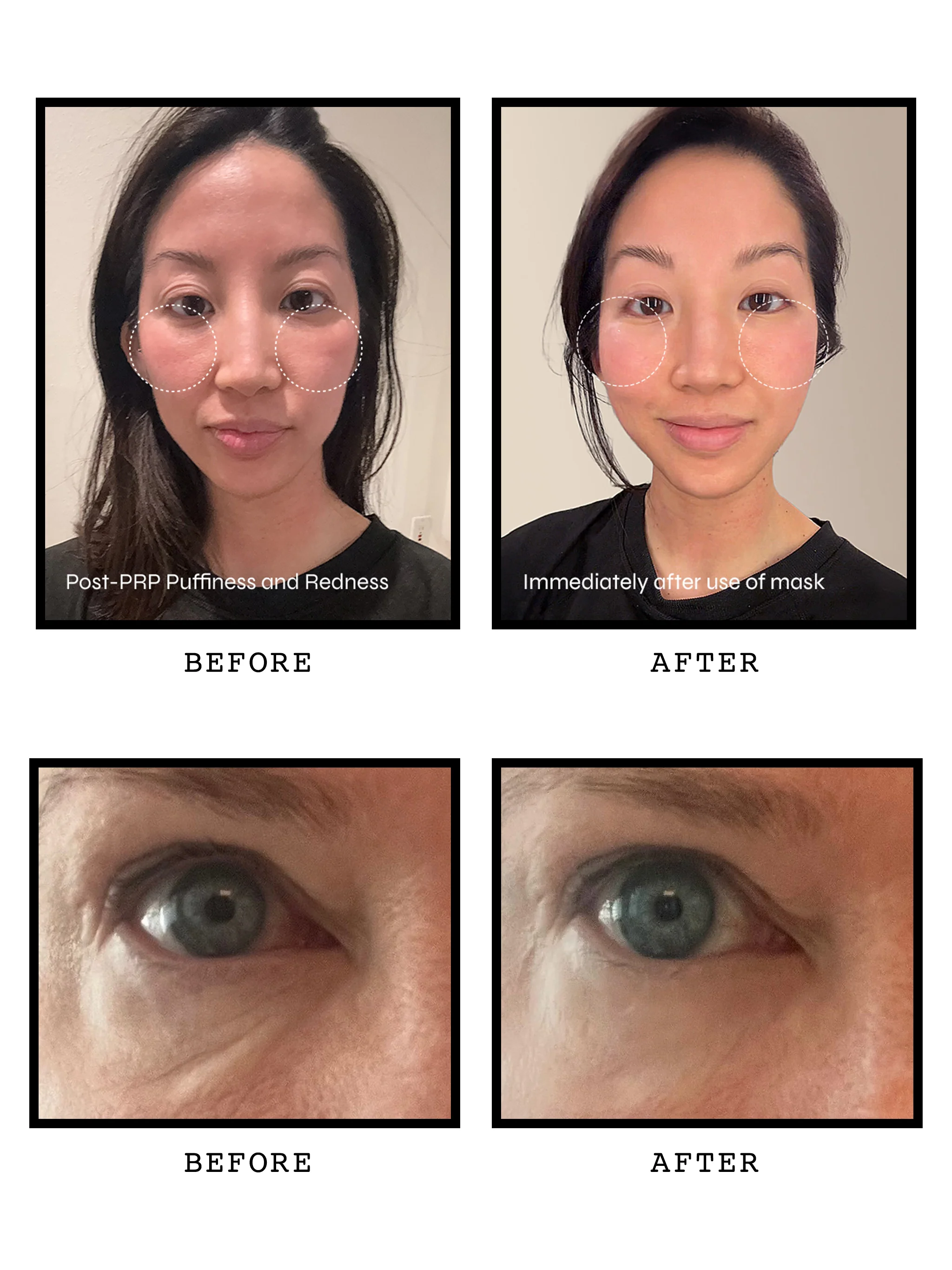 Damask Rose Revitalizing Gold-Infused Hydrogel Eye Masks - Image 3