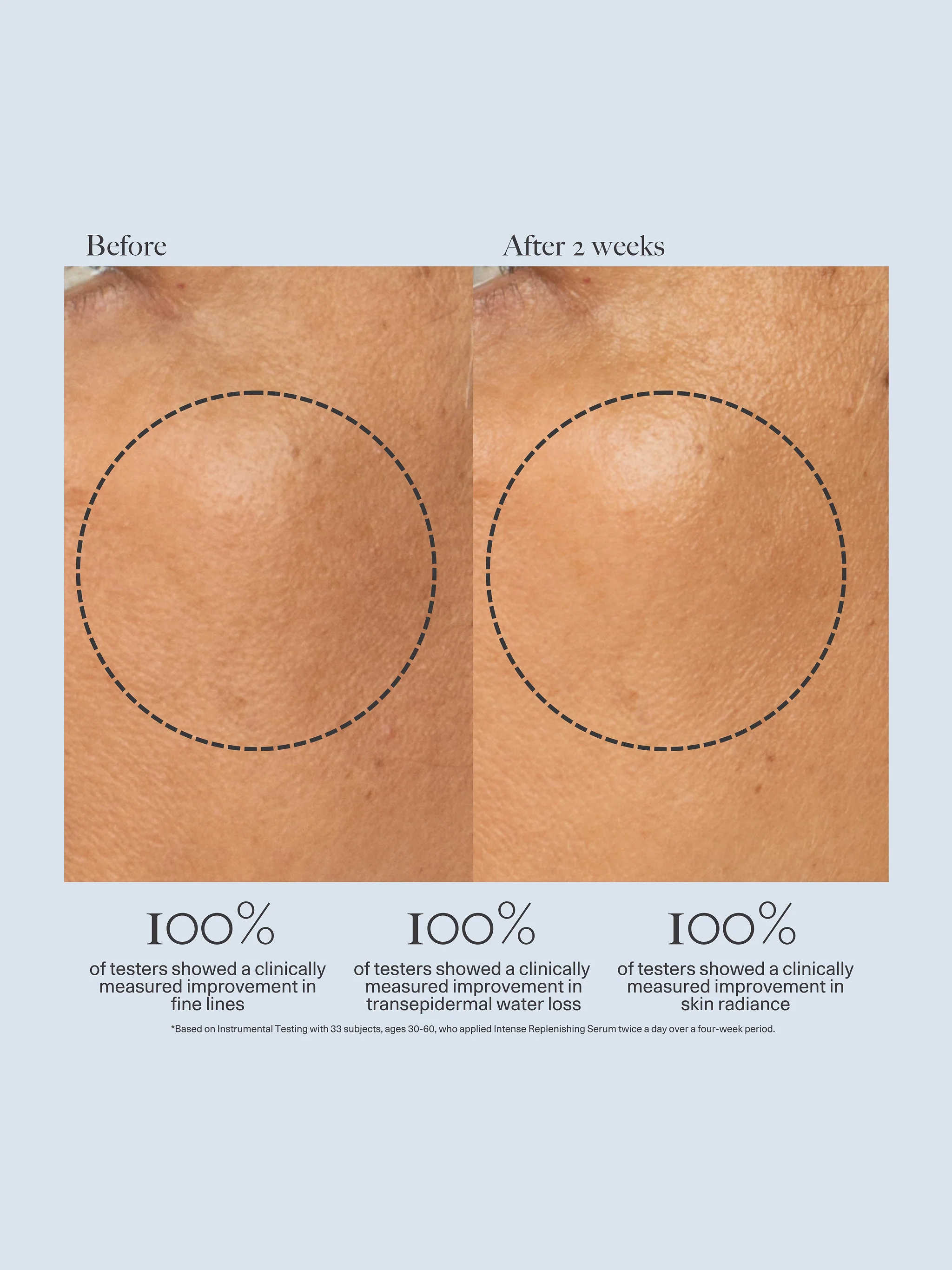 Intense Replenishing Serum - Image 3