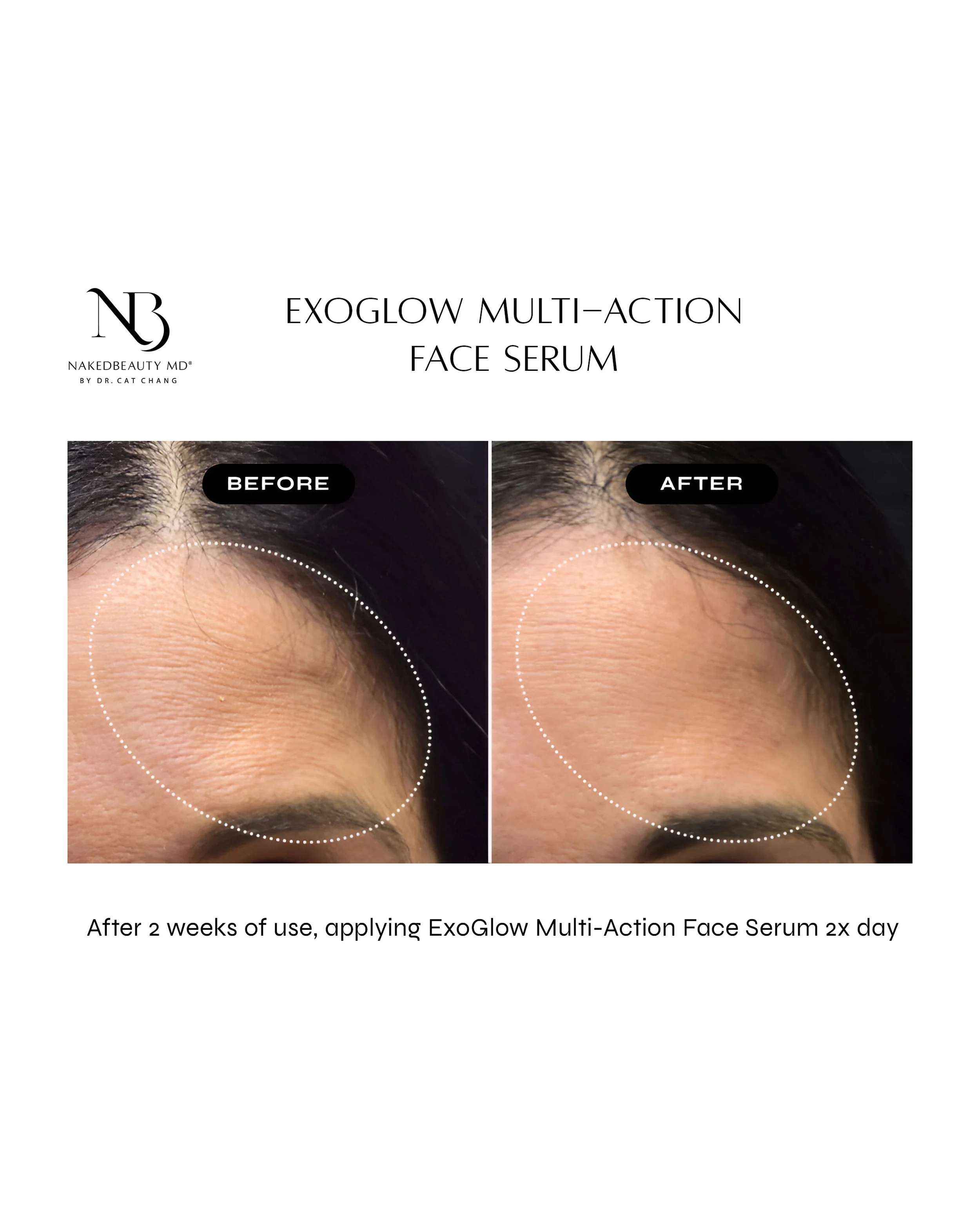 Exoglow Multi-Action Face Serum - Image 5