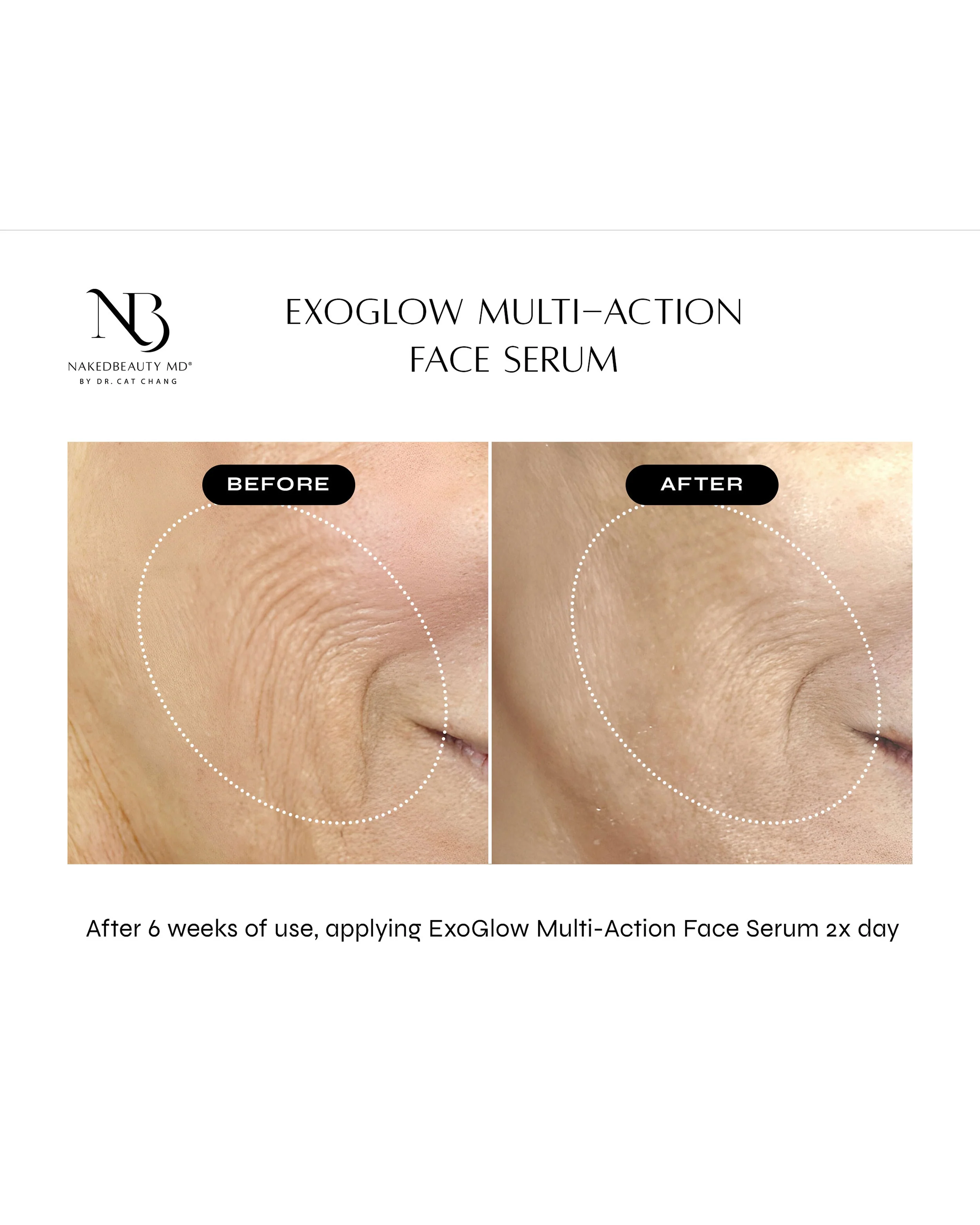 Exoglow Multi-Action Face Serum - Image 6