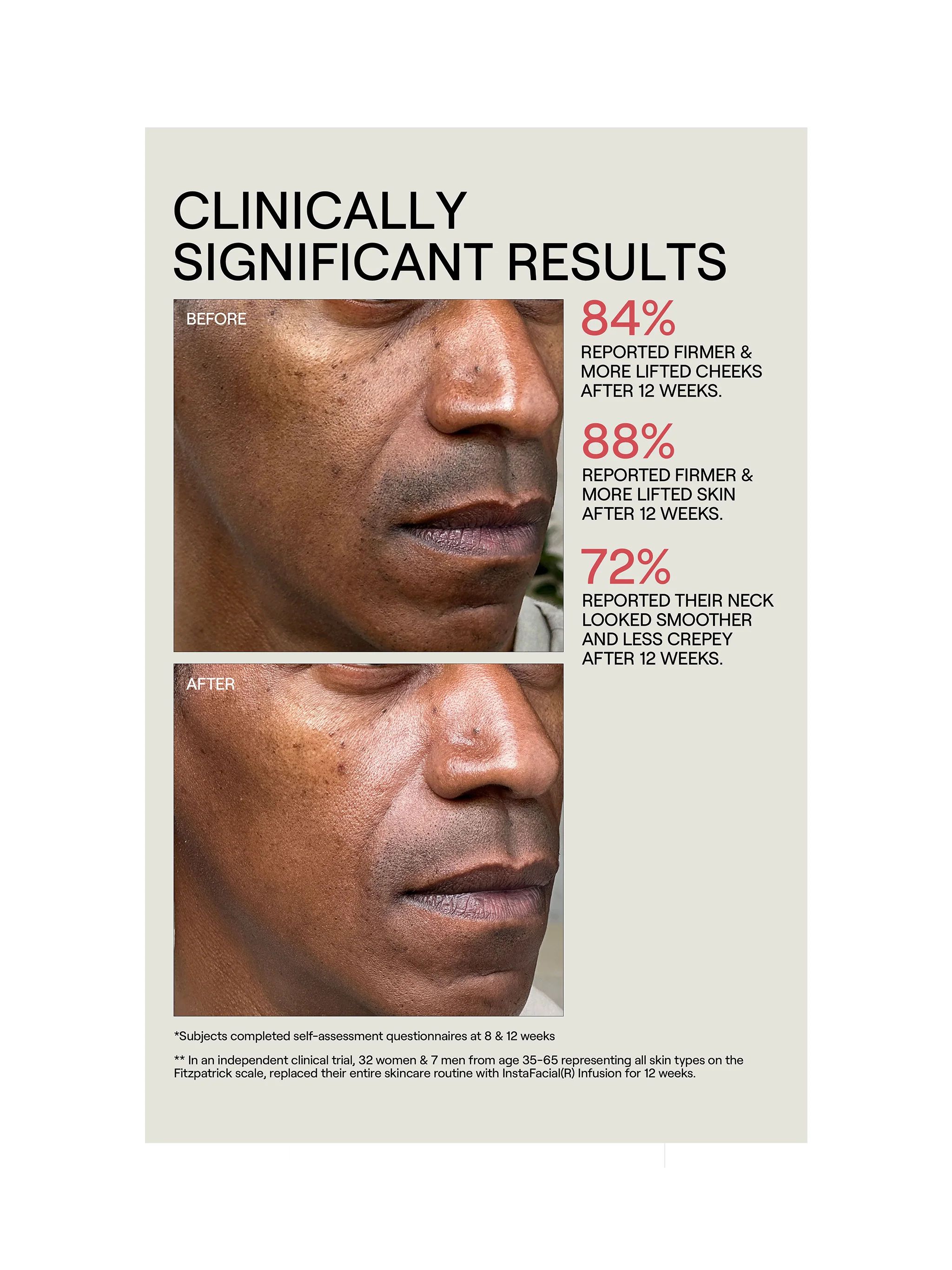 InstaFacial® Infusion - Image 3