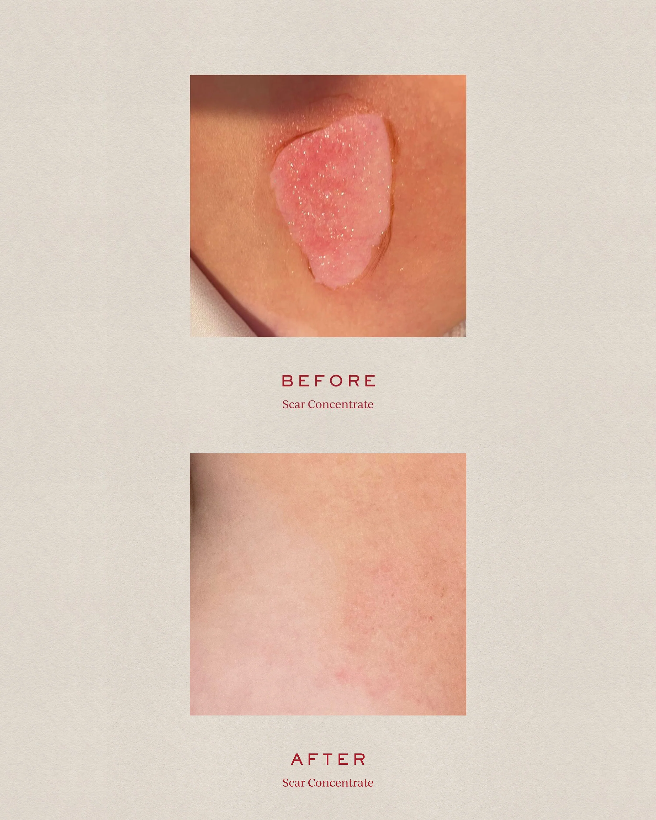 Scar Concentrate - Image 3