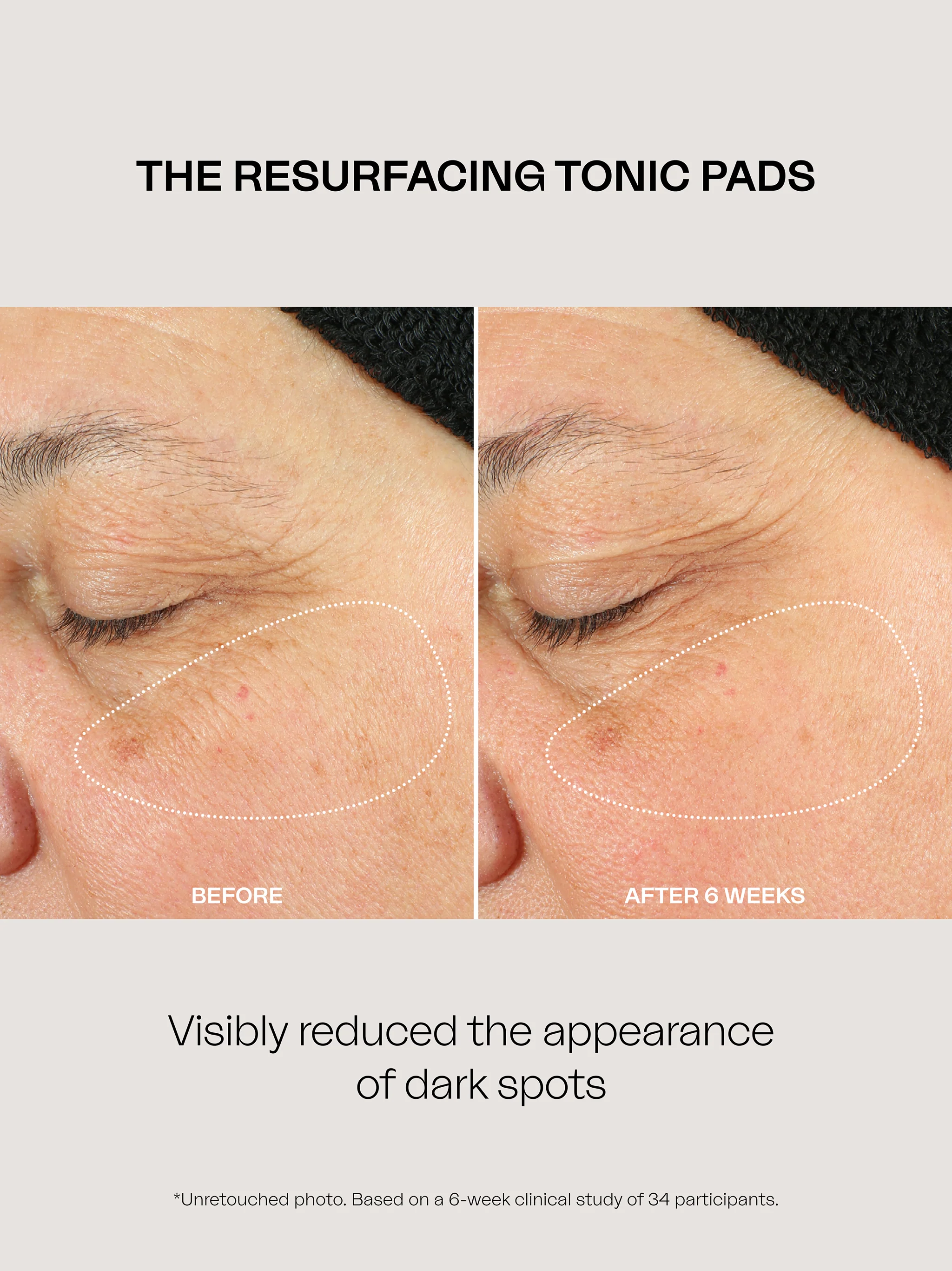 Resurfacing Tonic Pads - Image 3